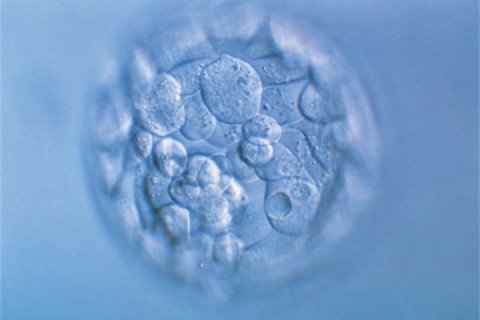 http://wenzhou.quanwangkm.com/post/190.html|温州人工试管